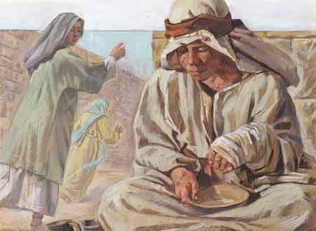 Tony, the Talmud says the curse of Canaan was leprosy. Do you know what leprosy is?